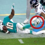 Tyreek Hill leg injury