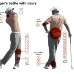 170421124054-tiger-woods-injuries-timeline